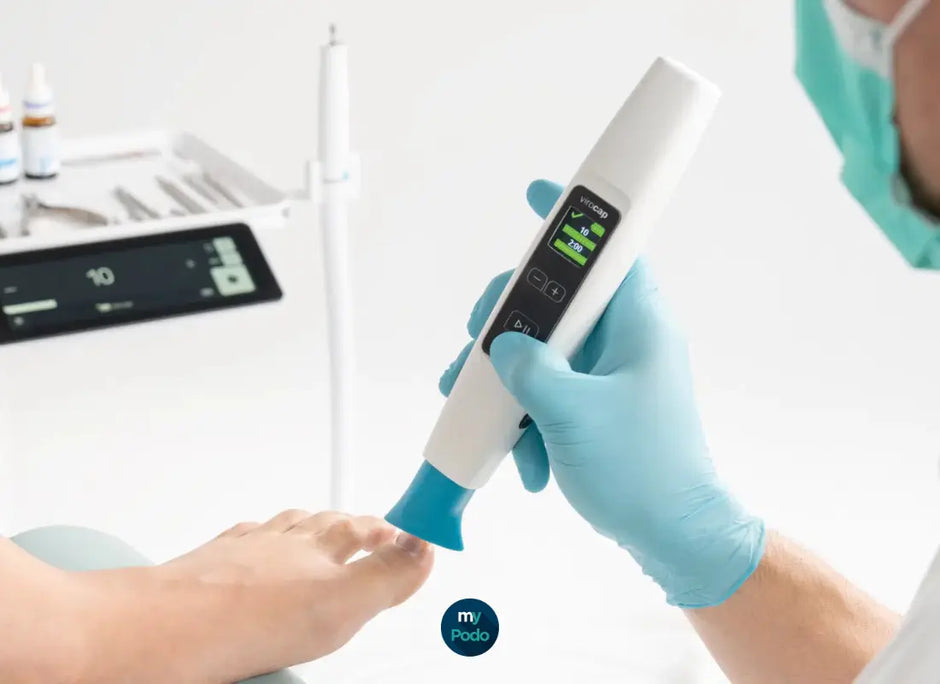 Protocole d'utilisation du ViroCap Ruck : traiter les mycoses au plasma froid My Podologie