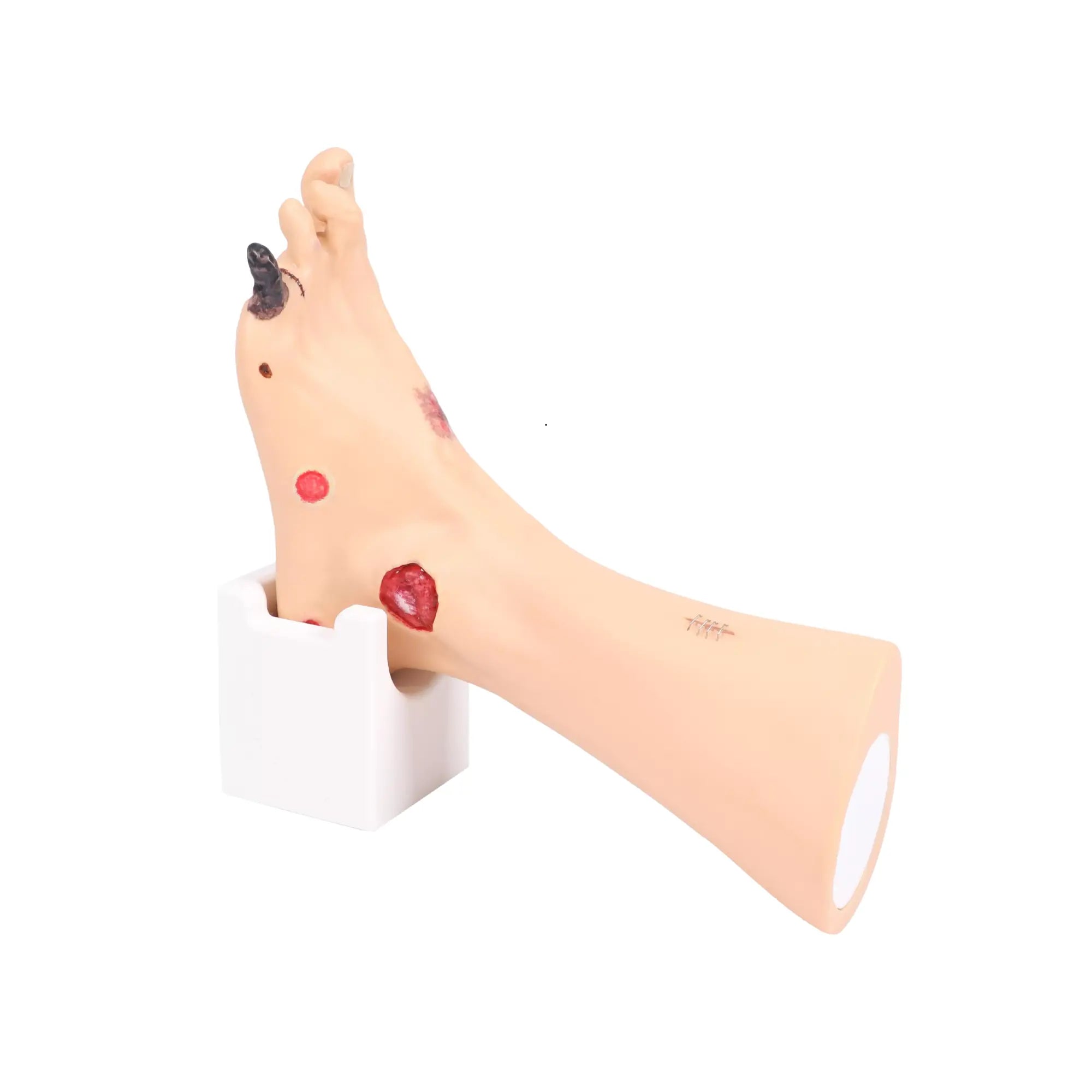 Foot model with wounds - Anatomy and pathology My Podiatry 